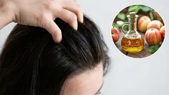Das Haar wird dicht und frei von grauen Haaren sein: Wie man Spülungen aus einfachen Zutaten herstellt